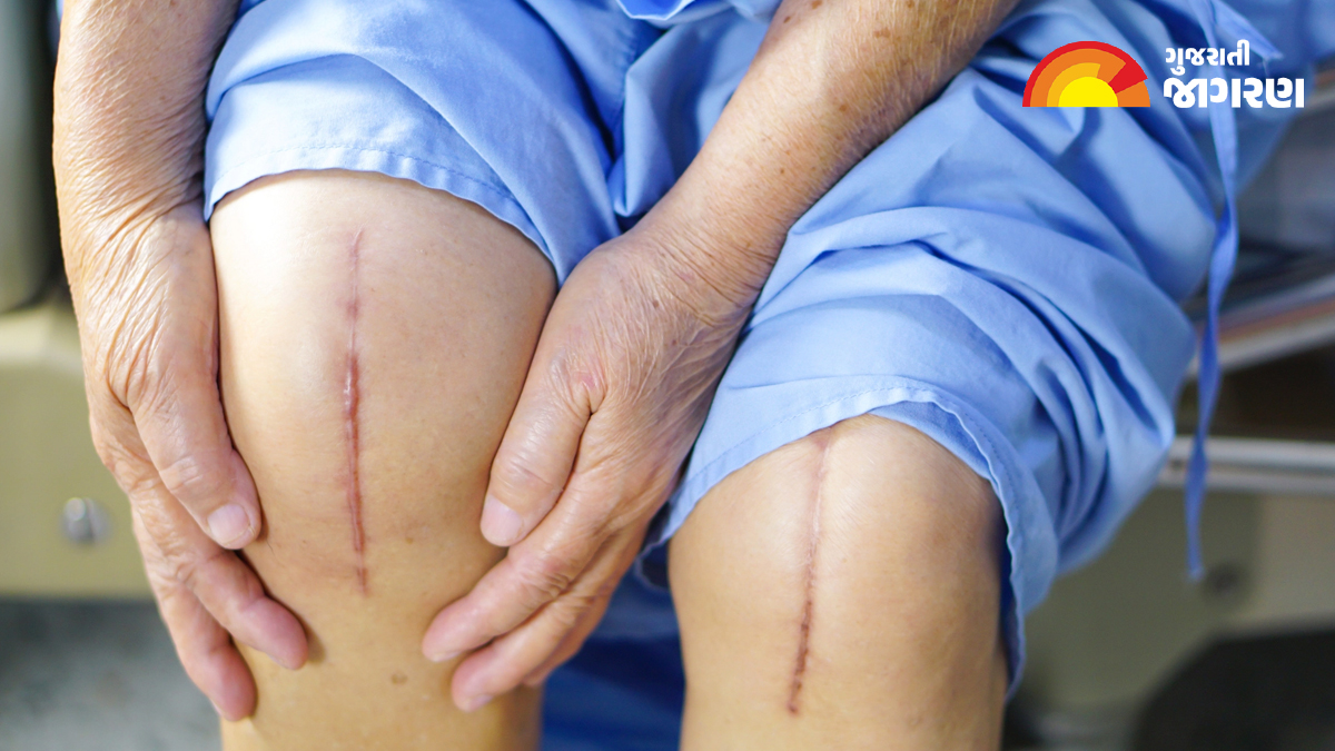 how-to-recover-quickly-after-knee-replacement-surgery-find-out-from-the-doctor-108437
