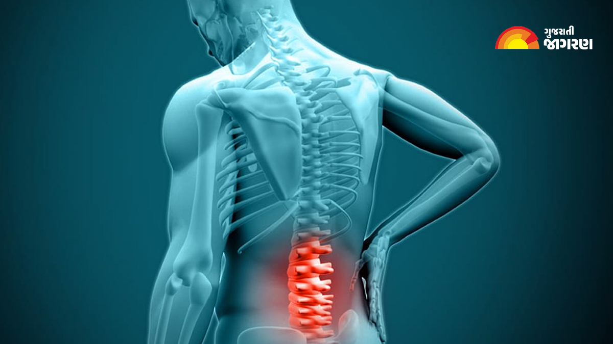 causing-slip-disc-problems-due-to-constant-sitting-and-incorrect-exercise-136825