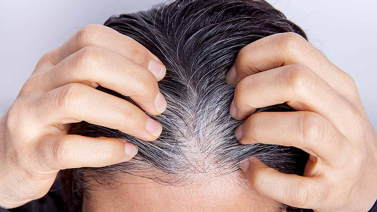 why-do-hairs-turn-white-at-a-young-age-299269