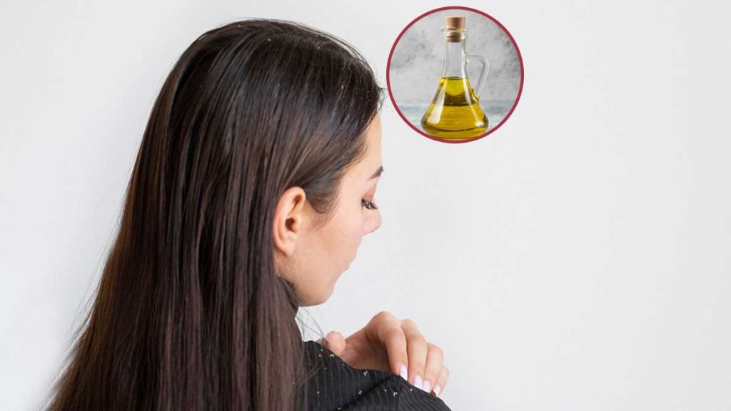 Dandruff treatment ડેન્ડ્રફને કહો બાય, સરસવના તેલમાં આ વસ્તુઓ મિક્સ