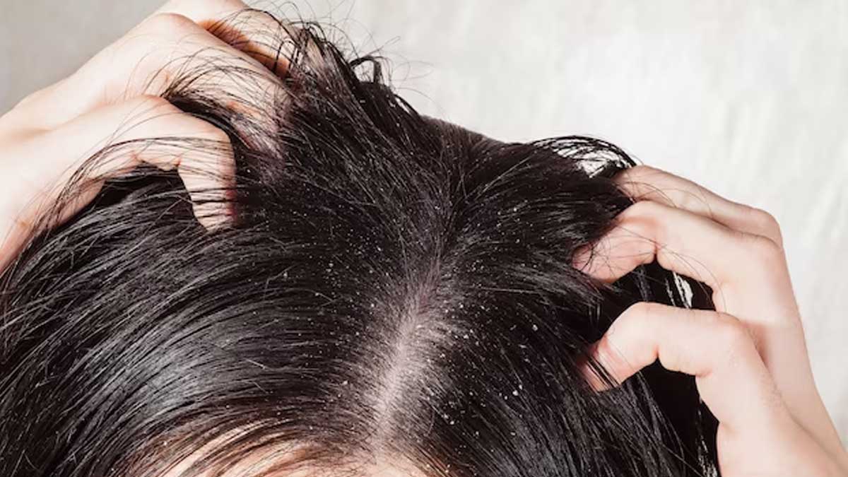 hair-care-tips-in-gujarati-how-do-i-stop-my-scalp-from-itching-and-drying-253900