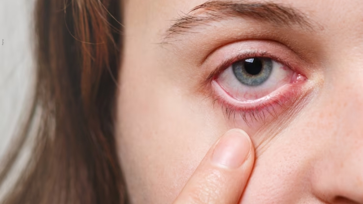 eye-tips-after-waking-up-in-the-morning-the-eyes-are-swollen-so-adopt-this-remedy-251801