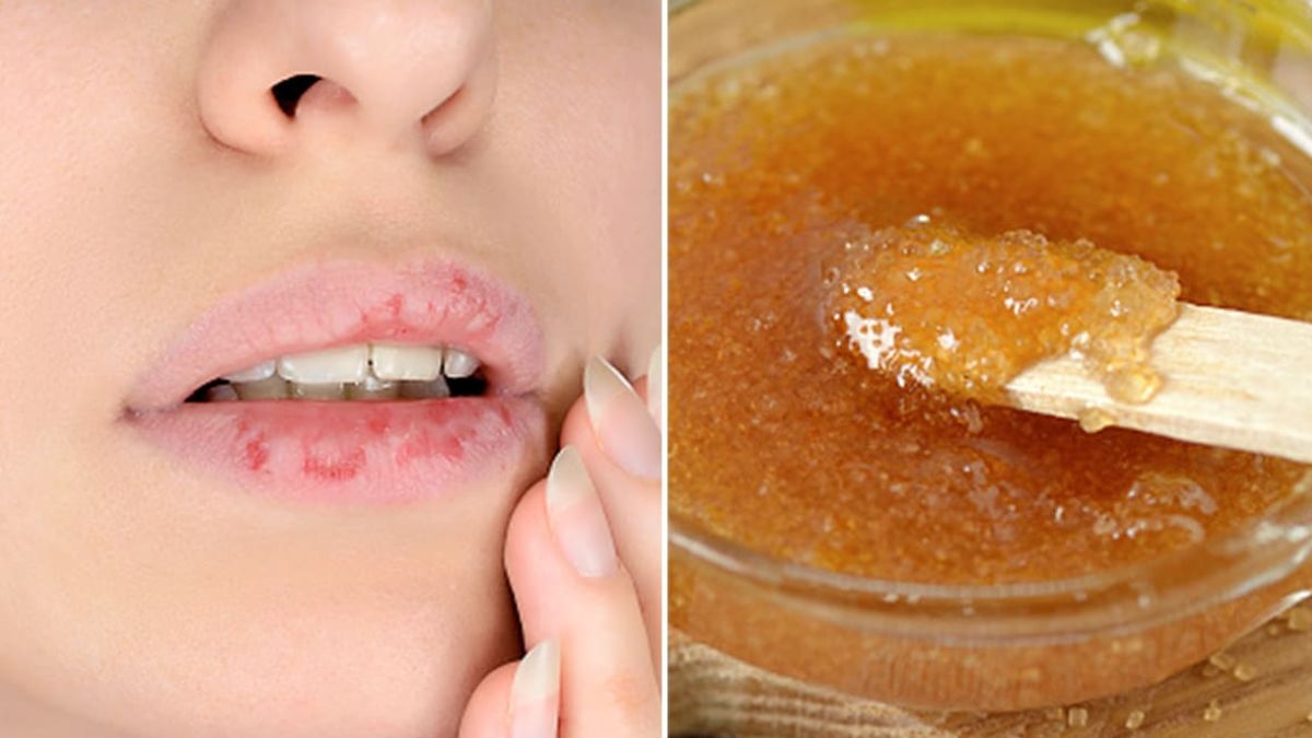 lips-beauty-tips-the-dead-skin-of-the-lips-will-turn-pink-just-do-these-4-things-at-home-258828