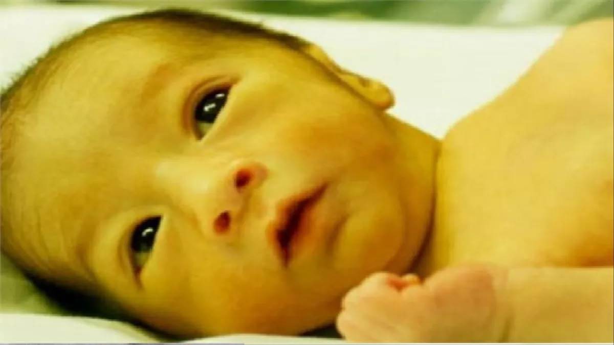 parenting-tips-in-gujarati-home-remedies-for-jaundice-in-child-272764