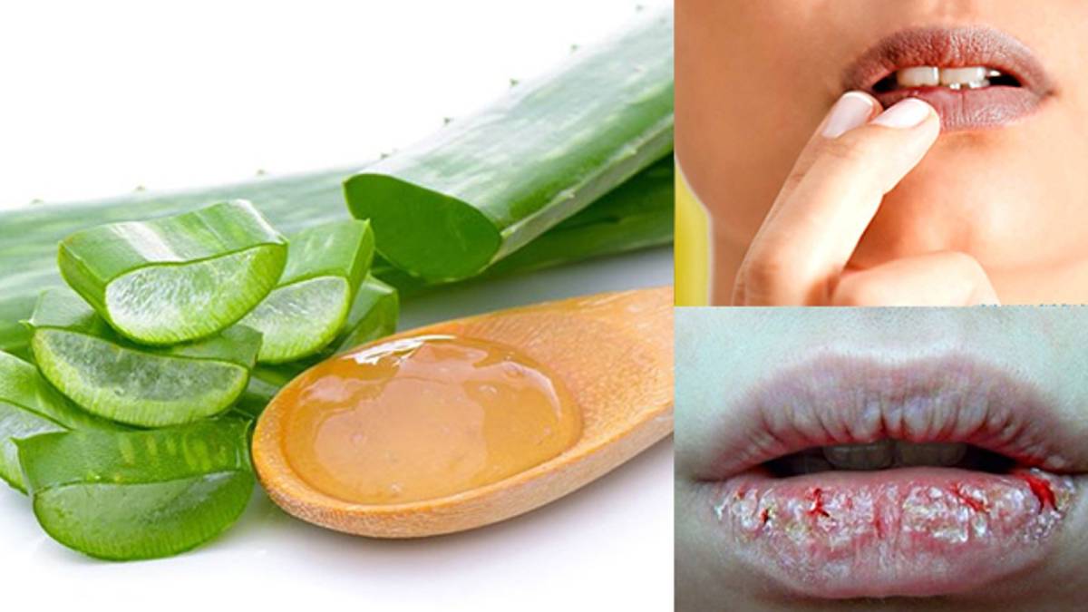 beauty-tips-in-gujarati-aloe-vera-on-lips-benefits-259889