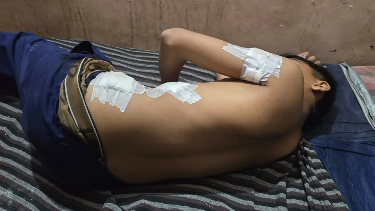 balasinore-student-attacked-with-paddle-after-fight-ahmedabad-like-incident-sparks-fear-and-worry-among-parents-589656