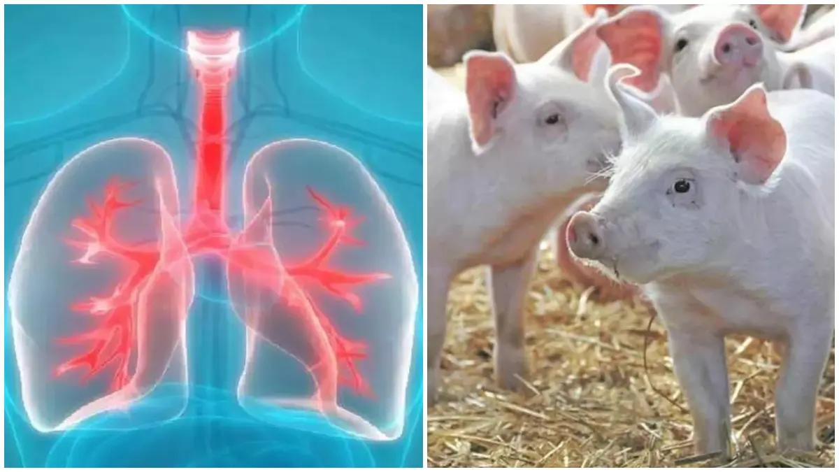 china-doctors-transplanted-pig-lungs-into-humans-592452
