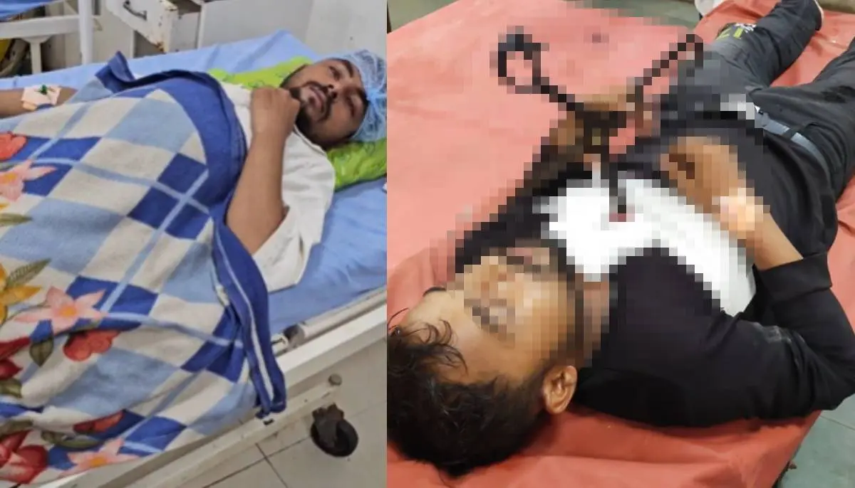 surat-news-tailor-injured-with-scissor-during-fun-with-friend-589363
