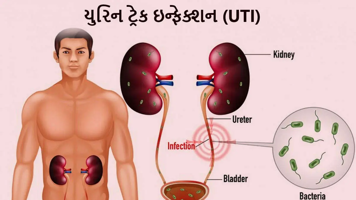 home-remedies-for-urinary-tract-infection-uti-relief-592017
