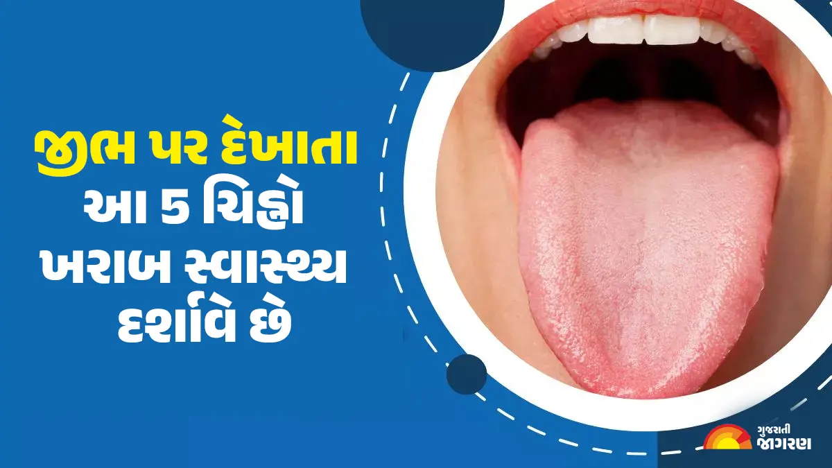 જીભ પર દેખાતા આ 5 ચિહ્નો ખરાબ સ્વાસ્થ્ય દર્શાવે છે, તેમને અવગણવાની ભૂલ નુકસાન પહોંચાડશે
