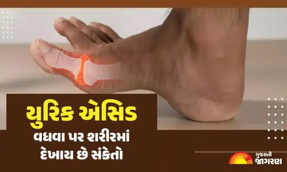 High Uric Acid: યુરિક એસિડ વધતા જ શરીરમાં દેખાવા લાગે છે આ 6 ફેરફારો; જાણો બચવાના રામબાણ ઉપાયો