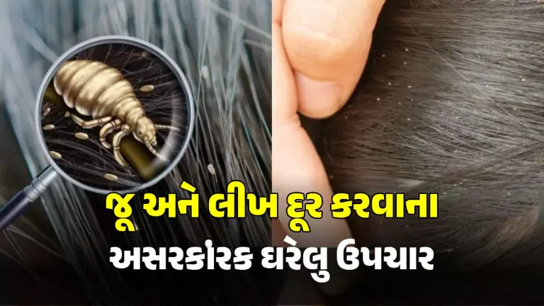 Nit Rid Home Remedies for Lice: વાળમાંથી જૂ અને લીખ દૂર કરવાના દેશી ઉપાય - How ...