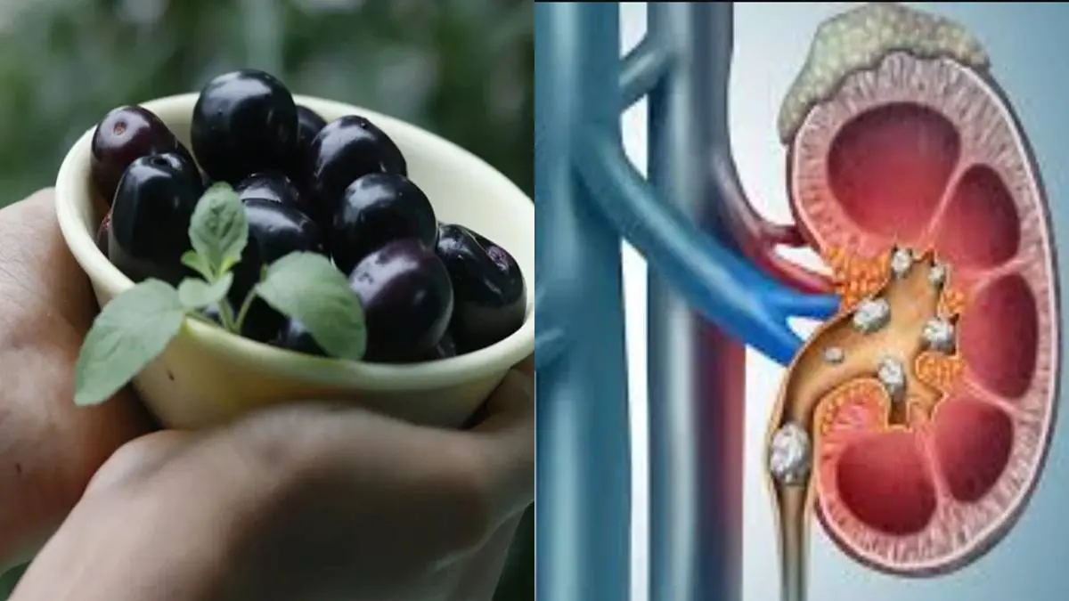 eat-this-fruit-daily-to-prevent-kidney-stones-says-ayurveda-expert-acharya-balkrishna-599138