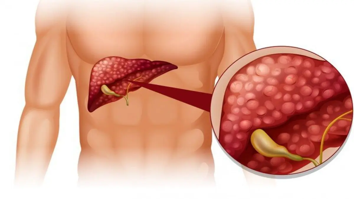 4-warning-signs-of-liver-cancer-which-should-never-be-ignored-check-details-here-602751