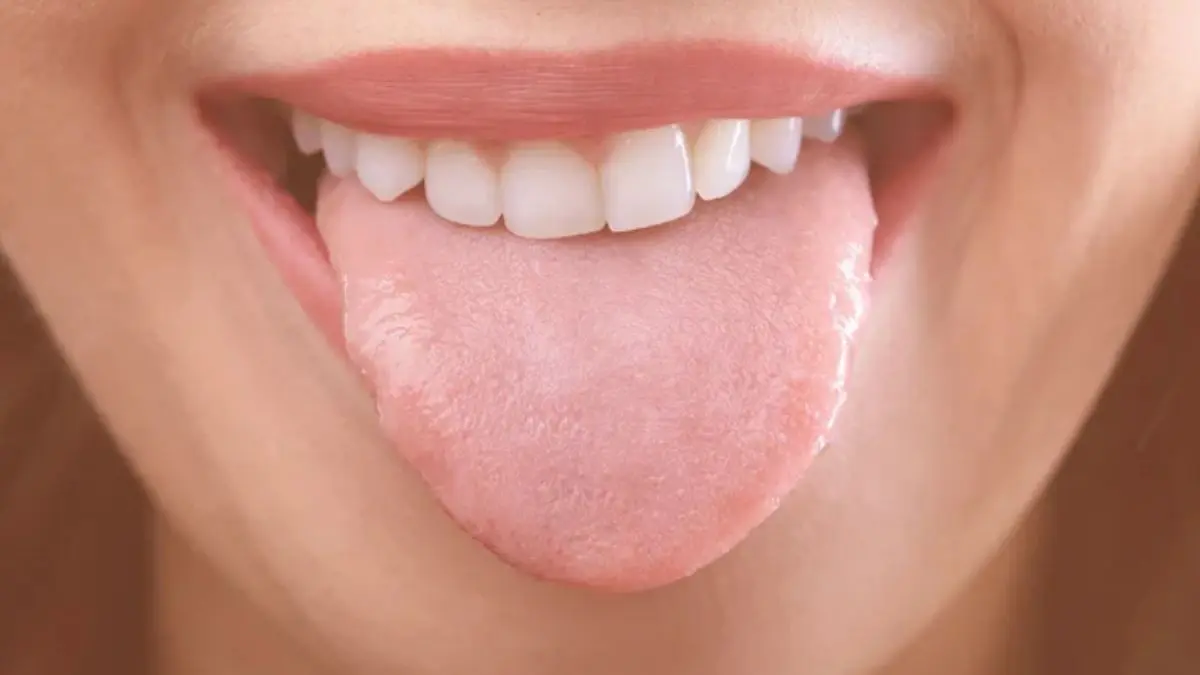these-5-signs-appearing-on-the-tongue-indicate-bad-health-ignoring-them-will-cause-harm-600452