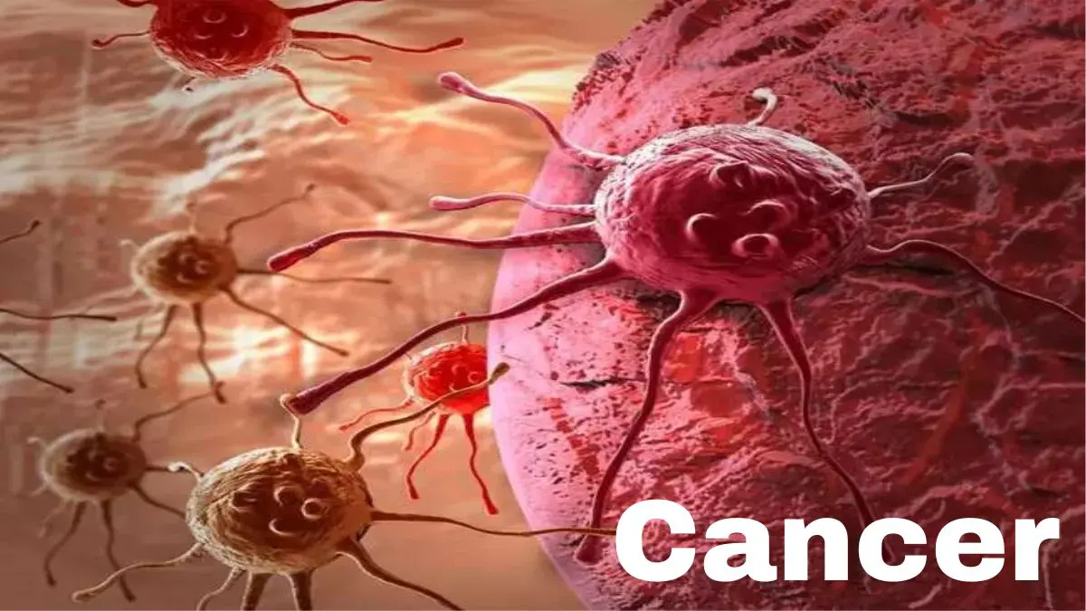 why-is-cancer-often-diagnosed-at-the-last-stage-597895