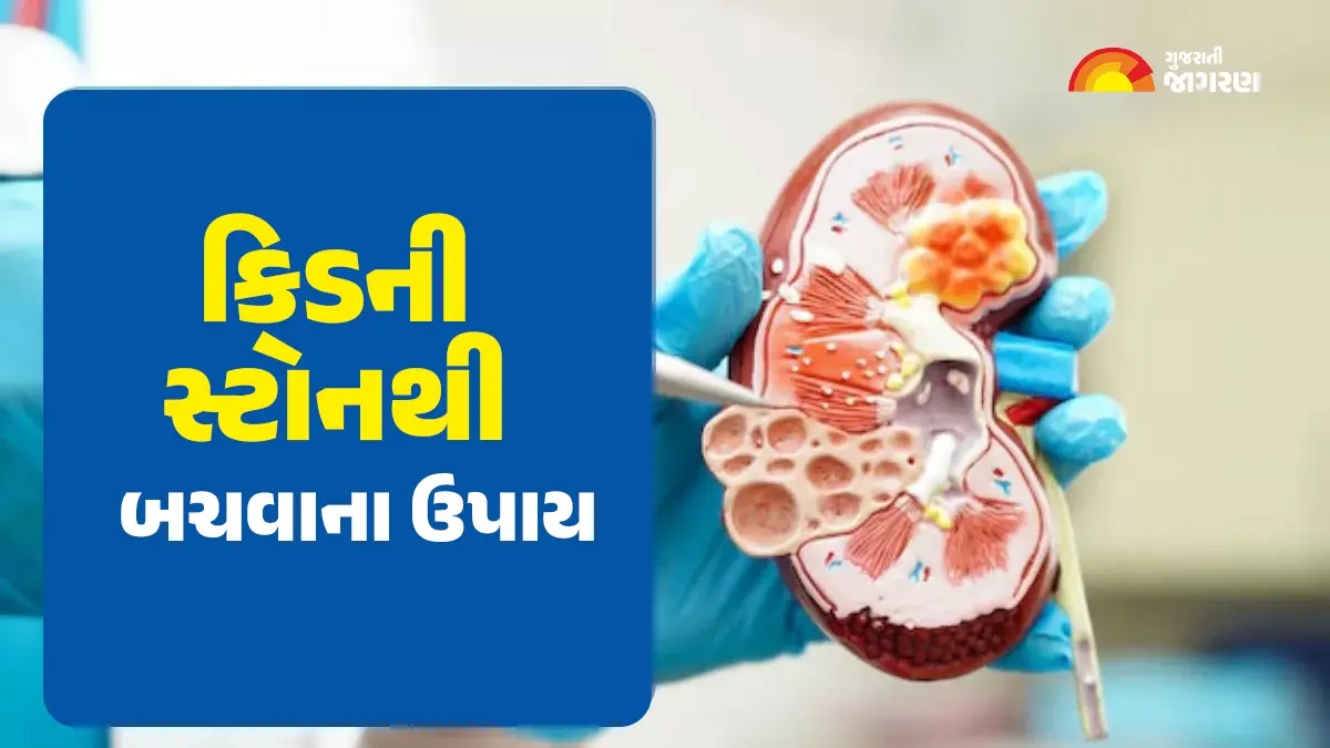 કિડનીમાં પથરીની સમસ્યા ધીમે ધીમે કિડનીને નુકસાન પહોંચાડવા લાગે છે, નિવારણ માટે આ 5 બાબતોનું ધ્યાન રાખો