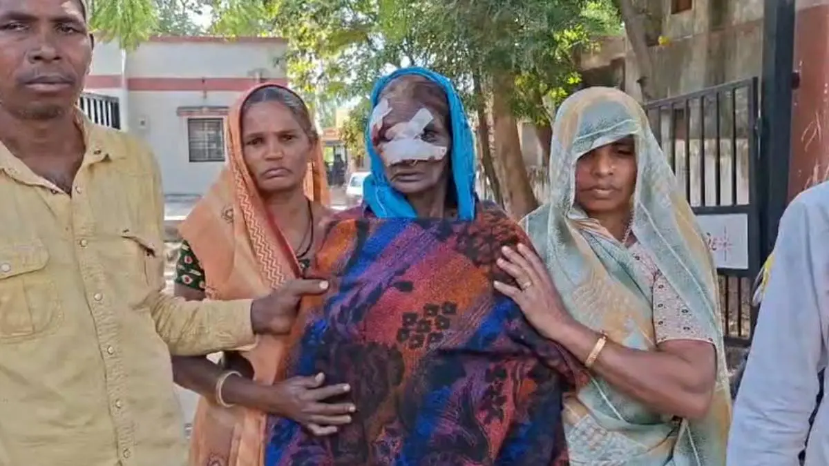 dahod-news-stray-dog-attack-on-ghughas-villagers-of-fatepura-taluka-649170