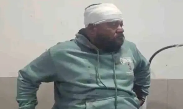 દાહોદમાં 'કાતિલ' દોરીનો કહેર: ઉત્તરાયણના 10 દિવસ બાદ વેપારીના કપાળના ભાગે 15 ટાંકા આવ્યા