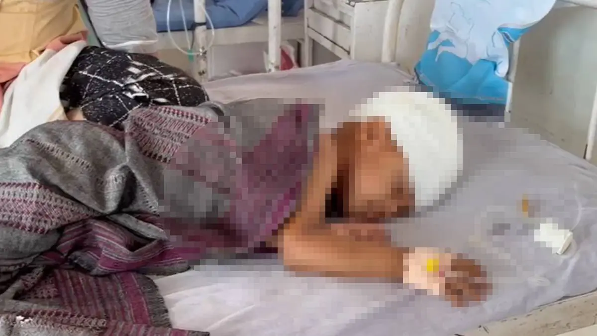 surat-stray-dogs-attack-3-year-old-child-near-valak-patiya-seriously-injured-686321