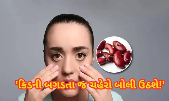 Kidney Failure Signs: કિડની ફેલ્યોરના આ 6 સંકેતો સૌથી પહેલા ચહેરા પર દેખાય છે, ભૂલથી પણ નજરઅંદાજ ન કરતા