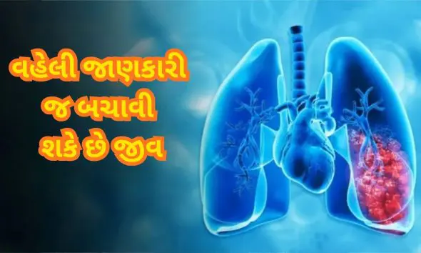 lung-cancer-symptoms-early-warning-signs-you-must-know