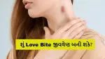 ગળા પર રોમાન્સનું આ નિશાન ક્યાંક ભારે ન પડી જાય! જાણો લવ બાઈટ ક્યારે બને છે જીવનું જોખમ