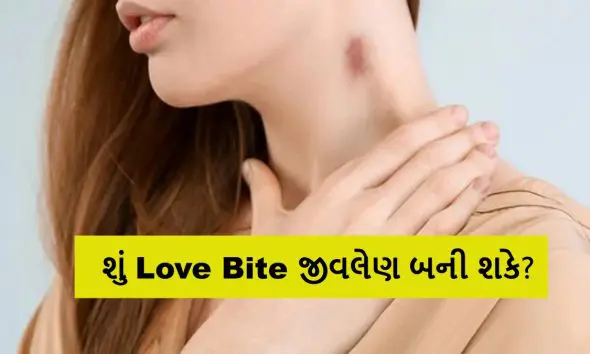 can-love-bite-cause-death-hickey-risks