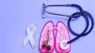 World Lung Cancer Day 2026: દર વર્ષે 98 હજારથી વધુ લોકોનો જીવ લે છે ફેફસાનું કેન્સર, જાણો ચોંકાવનારા આંકડા