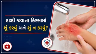 દાઝી જાઓ તો ગભરાશો નહીં! જાણો પ્રાથમિક સારવારના કિસ્સામાં શું કરવું અને શું ન કરવું?