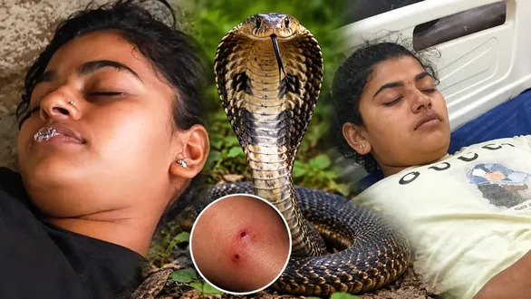 omg-news-snake-bites-hathras-college-girl-8-times-in-45-days-doctors-left-baffled