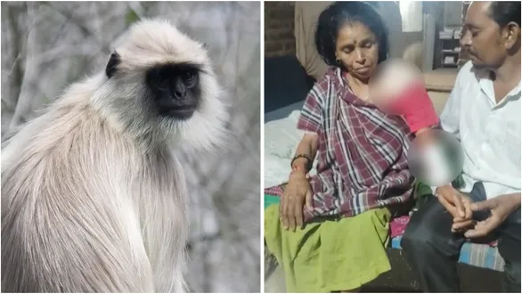 karjan-kanbha-village-monkey-attack-woman-injured-32-stitches