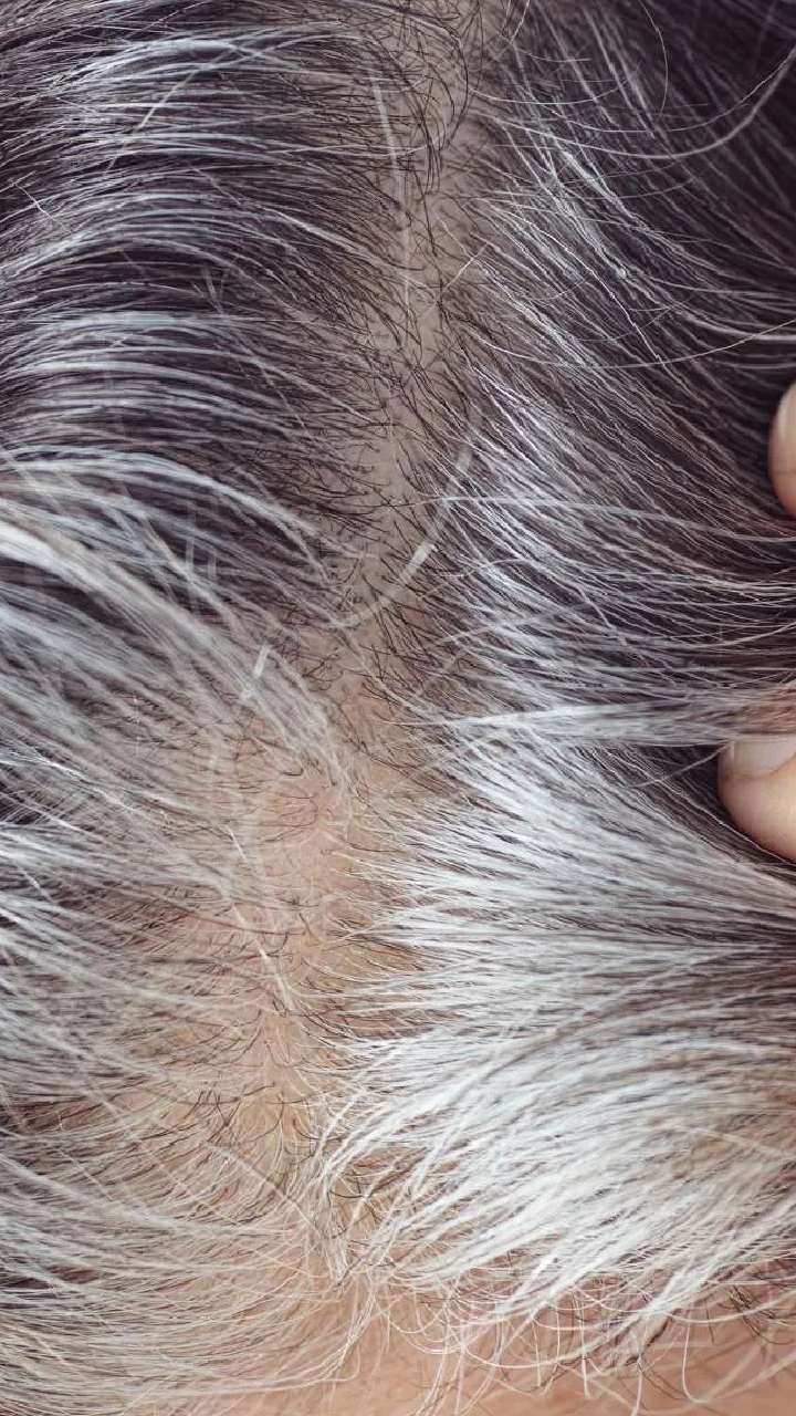 વાળને કુદરતી રીતે કાળા કરવા માટે આ ઉપાયો અજમાવો