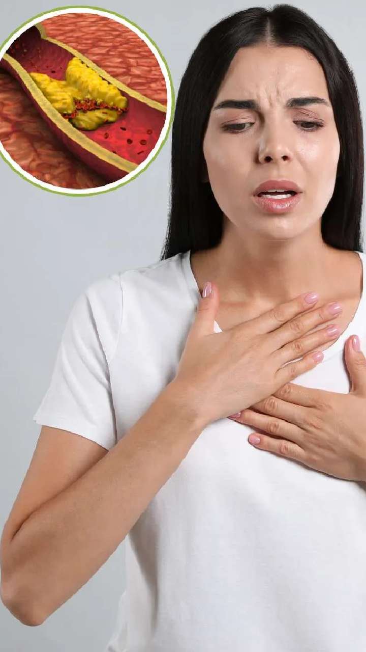 કોલેસ્ટ્રોલ વધવાના 7 મુખ્ય કારણો